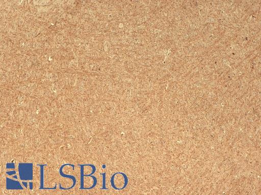 IHC analysis of CASPR using CNTNAP1 / CASPR / p190 antibody, tested on mouse brain. Staining of myelin fibers. All the myelin fibers appear positive.