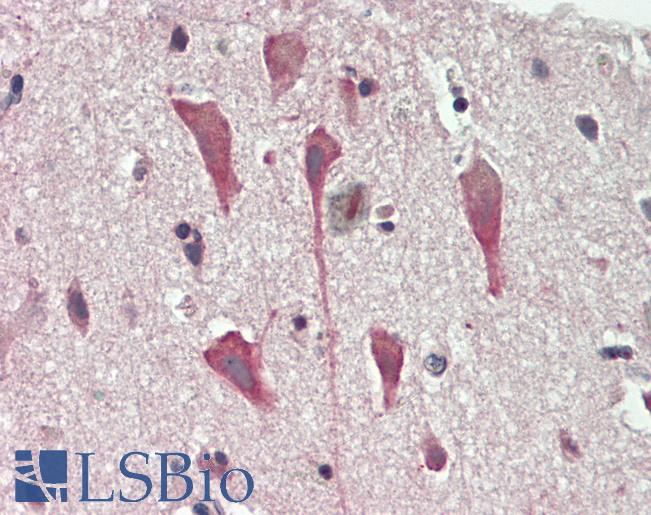 Human Brain, Cortex: Formalin-Fixed, Paraffin-Embedded (FFPE)