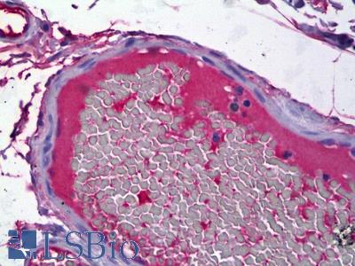 Anti-FGB / Fibrinogen Beta Chain antibody IHC of human small intestine, intravascular plasma. Immunohistochemistry of formalin-fixed, paraffin-embedded tissue after heat-induced antigen retrieval. Antibody LS-B6670 concentration 10 ug/ml.