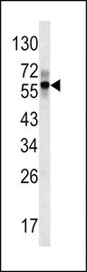 Western blot of FIBB antibody in mouse liver tissue lysates (35 ug/lane). FIBB (arrow) was detected using the purified antibody.