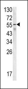 Western blot of FIBB antibody in T47D cell line lysates (35 ug/lane). FIBB (arrow) was detected using the purified antibody.