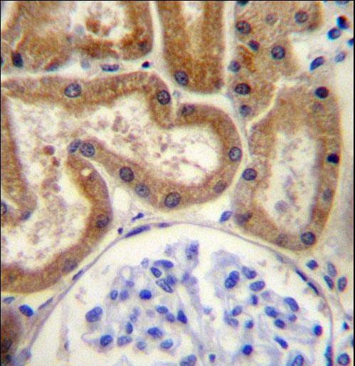 FGD2 Antibody immunohistochemistry of formalin-fixed and paraffin-embedded human kidney tissue followed by peroxidase-conjugated secondary antibody and DAB staining.