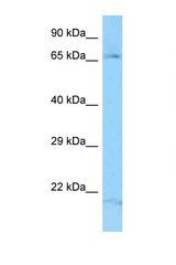 FGD3 antibody LS-C146297 Western blot of Fetal Lung lysate. Antibody concentration 1 ug/ml.