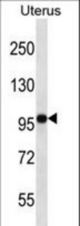 FGD4 Antibody western blot of human normal Uterus tissue lysates (35 ug/lane). The FGD4 antibody detected the FGD4 protein (arrow).