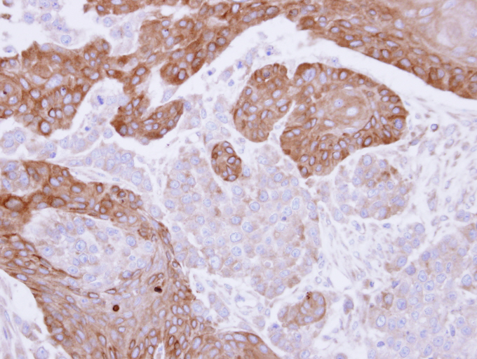 IHC of paraffin-embedded SG xenograft using FGD4 antibody at 1:100 dilution.