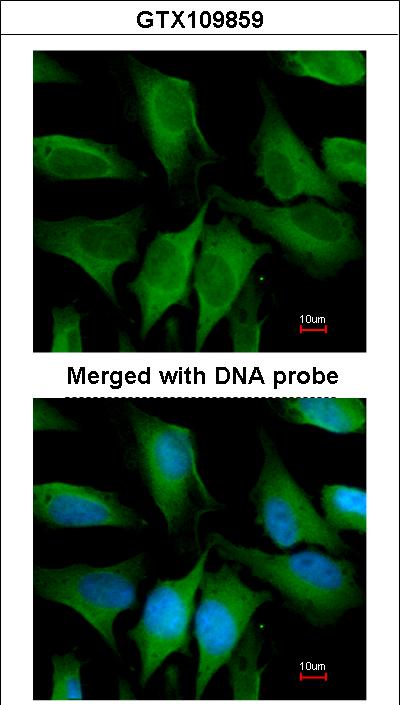 Immunofluorescence of paraformaldehyde-fixed HeLa using FGD4 antibody at 1:200 dilution.