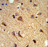 Formalin-fixed and paraffin-embedded mouse brain tissue reacted with CNTNAP2 Antibody , which was peroxidase-conjugated to the secondary antibody, followed by DAB staining. This data demonstrates the use of this antibody for immunohistochemistry; clinical relevance has not been evaluated.