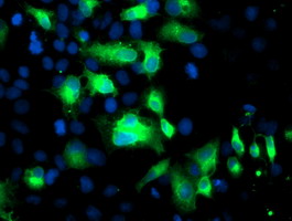 Anti-FGFR2 mouse monoclonal antibody immunofluorescent staining of COS7 cells transiently transfected by pCMV6-ENTRY FGFR2.