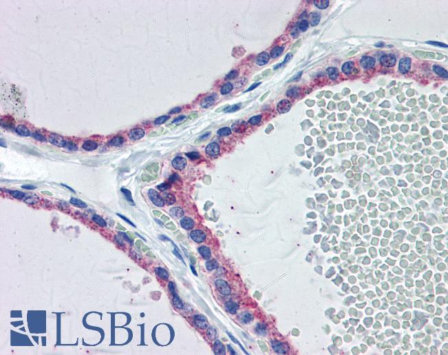 Anti-FGFR2 antibody IHC of human thyroid. Immunohistochemistry of formalin-fixed, paraffin-embedded tissue after heat-induced antigen retrieval. Antibody LS-B5979 concentration 5 ug/ml.
