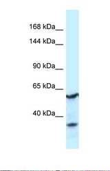 Western blot of Human Fetal Kidney . CNTROB antibody dilution 1.0 ug/ml.