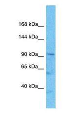 Western blot of CNTROB Antibody with human HepG2 Whole Cell lysate.