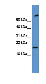 FGF1 antibody LS-C134983 Western blot of Mouse Heart lysate.