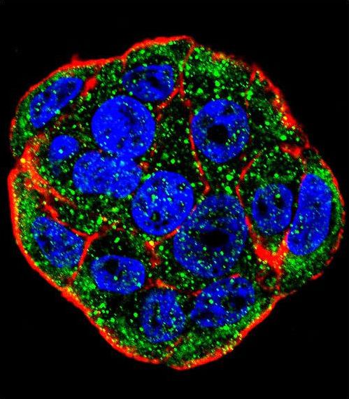 Confocal immunofluorescent of FGF1 Antibody with WiDr cell followed by Alexa Fluor 488-conjugated goat anti-rabbit lgG (green). Actin filaments have been labeled with Alexa Fluor 555 phalloidin (red). DAPI was used to stain the cell nuclear (blue).
