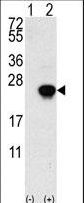 Western blot of FGF1 (arrow) using rabbit polyclonal FGF1 Antibody. 293 cell lysates (2 ug/lane) either nontransfected (Lane 1) or transiently transfected with the FGF1 gene (Lane 2) (Origene Technologies).