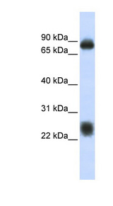 TSPAN8 antibody LS-C111102 Western blot of Fetal Brain lysate.