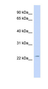 FGF11 antibody LS-C135322 Western blot of Fetal muscle lysate.