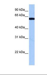 Fetal brain cell lysate. Antibody concentration: 0.5 ug/ml. Gel concentration: 12%.