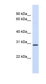 FGF14 antibody LS-C135323 Western blot of Fetal Lung lysate.