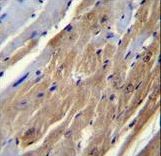 FGF16 Antibody immunohistochemistry of formalin-fixed and paraffin-embedded mouse heart tissue followed by peroxidase-conjugated secondary antibody and DAB staining.