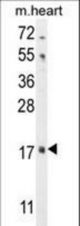 FGF16 Antibody western blot of mouse heart tissue lysates (35 ug/lane). The FGF16 antibody detected the FGF16 protein (arrow).