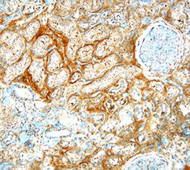 FGF-17 in Human Kidney. FGF-17 was detected in immersion fixed paraffin-embedded sections of human kidney using Human FGF-17 Monoclonal Antibody at 8 ug/ml overnight at 4°C. Tissue was stained using Anti-Mouse HRP-DAB (brown) and counterstained with hematoxylin (blue). Specific labeling was localized to the basement membrane supporting epithelial cells.