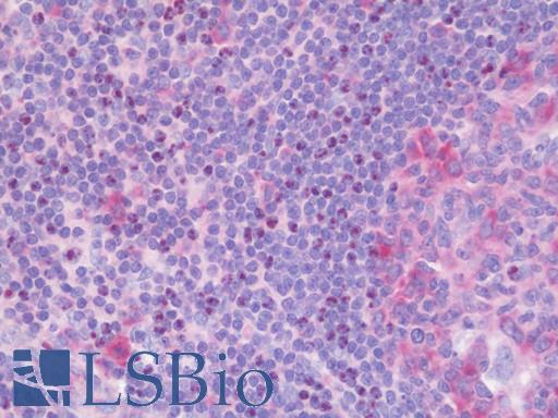 Anti-FGF18 antibody IHC staining of human tonsil. Immunohistochemistry of formalin-fixed, paraffin-embedded tissue after heat-induced antigen retrieval. Antibody LS-B10539 dilution 1:50.