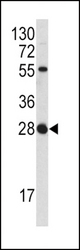 Western blot of FGF18 antibody in NCI-H460 cell line lysates (35 ug/lane). FGF18 (arrow) was detected using the purified antibody.