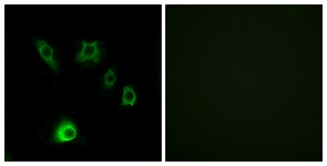 Immunofluorescence of HUVEC cells, using FGF18 Antibody. The picture on the right is treated with the synthesized peptide.