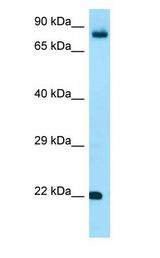 FGF18 antibody Western Blot of ACHN.