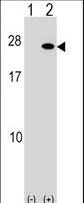 Western blot of FGF19 (arrow) using rabbit polyclonal FGF19 Antibody. 293 cell lysates (2 ug/lane) either nontransfected (Lane 1) or transiently transfected (Lane 2) with the FGF19 gene.