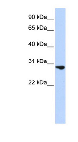 FGF2 / BFGF antibody LS-C110665 Western blot of Jurkat lysate.