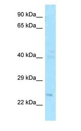 FGF20 antibody Western Blot of Fetal Brain.