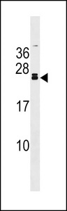 FGF20 Antibody western blot of mouse kidney tissue lysates (35 ug/lane). The FGF20 antibody detected the FGF20 protein (arrow).