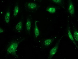 Immunofluorescent staining of HeLa cells using anti-FGF21 mouse monoclonal antibody.