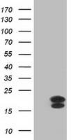 HEK293T cells were transfected with the pCMV6-ENTRY control (Left lane) or pCMV6-ENTRY FGF21 (Right lane) cDNA for 48 hrs and lysed. Equivalent amounts of cell lysates (5 ug per lane) were separated by SDS-PAGE and immunoblotted with anti-FGF21.