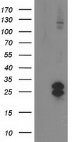 HEK293T cells were transfected with the pCMV6-ENTRY control (Left lane) or pCMV6-ENTRY FGF21 (Right lane) cDNA for 48 hrs and lysed. Equivalent amounts of cell lysates (5 ug per lane) were separated by SDS-PAGE and immunoblotted with anti-FGF21.