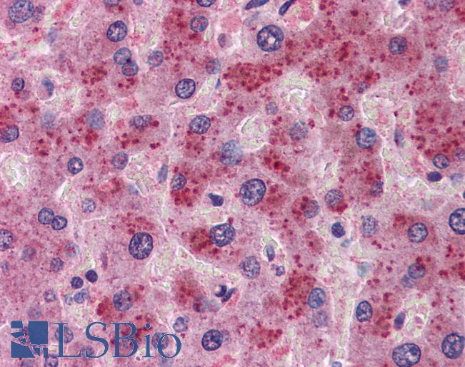 Anti-FGF21 antibody IHC of human liver. Immunohistochemistry of formalin-fixed, paraffin-embedded tissue after heat-induced antigen retrieval. Antibody LS-B5864 concentration 5 ug/ml.