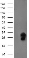 HEK293T cells were transfected with the pCMV6-ENTRY control (Left lane) or pCMV6-ENTRY FGF21 (Right lane) cDNA for 48 hrs and lysed. Equivalent amounts of cell lysates (5 ug per lane) were separated by SDS-PAGE and immunoblotted with anti-FGF21.