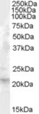 Antibody (1 ug/ml) staining of Human Liver lysate (35 ug protein in RIPA buffer). Primary incubation was 1 hour. Detected by chemiluminescence.