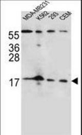 FGF22 Antibody western blot of MDA-MB231,K562,293,CEM cell line lysates (35 ug/lane). The FGF22 antibody detected the FGF22 protein (arrow).
