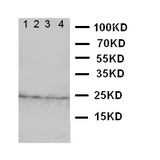 WB of FGF22 antibody. Lane 1: Rat Ovary Tissue Lysate. Lane 2: Rat Ovary Tissue Lysate. Lane 3: Rat Testis Tissue Lysate. Lane 4: Rat Testis Tissue Lysate.
