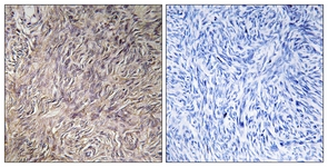 IHC of paraffin-embedded human ovary tissue, using FGF22 Antibody. The picture on the right is treated with the synthesized peptide.