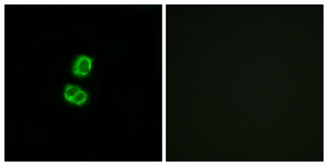 Immunofluorescence of MCF7 cells, using FGF22 Antibody. The picture on the right is treated with the synthesized peptide.