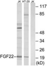 Western blot of extracts from Jurkat/HT-29 cells, using FGF22 Antibody. The lane on the right is treated with the synthesized peptide.