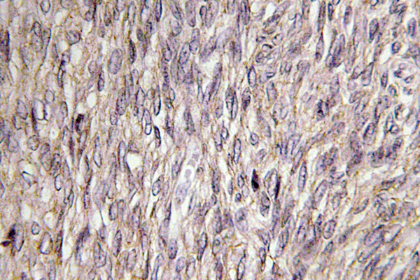 IHC of FGF-22 (A96) pAb in paraffin-embedded human ovary tissue.