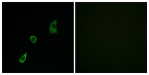 Immunofluorescence of HUVEC cells, using FGF23 Antibody. The picture on the right is treated with the synthesized peptide.