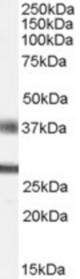 Antibody (0.5 ug/ml) staining of human brain (Hippocampus) lysate (35 ug protein in RIPA buffer). Primary incubation was 1 hour. Detected by chemiluminescence.