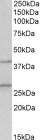 FGF23 antibody (0.5 ug/ml) staining of Mouse Brain lysate (35 ug protein in RIPA buffer). Primary incubation was 1 hour. Detected by chemiluminescence.