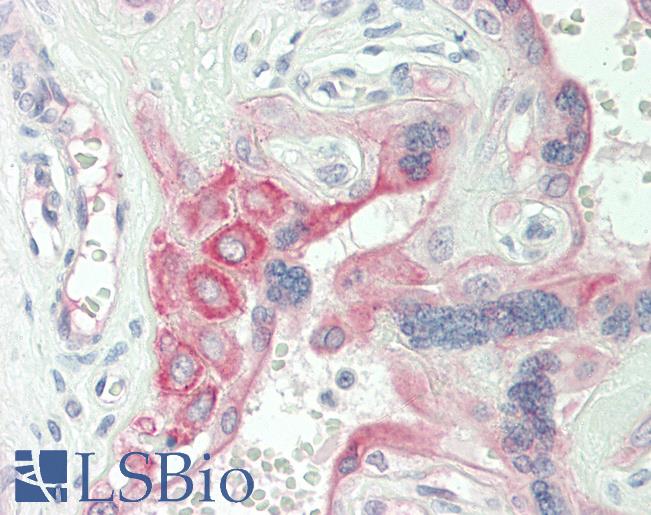 Human Placenta: Formalin-Fixed, Paraffin-Embedded (FFPE)