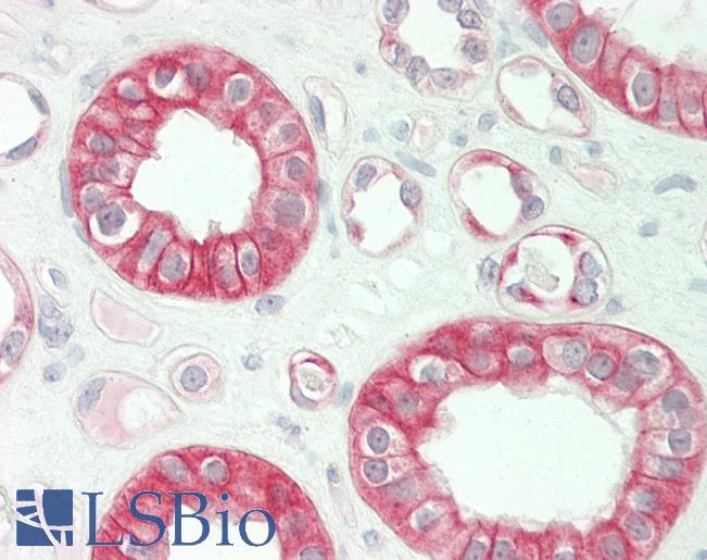 Human Kidney: Formalin-Fixed, Paraffin-Embedded (FFPE)